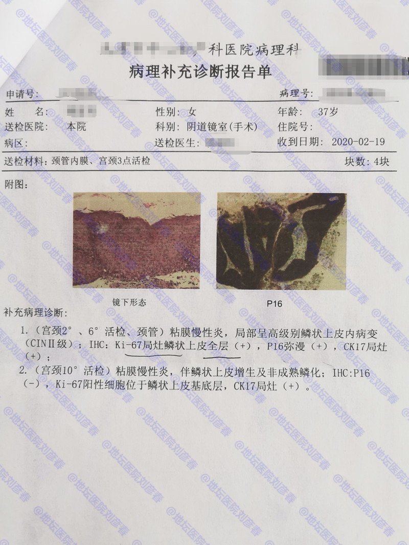 女性尿频腰酸和hpv有关吗,外阴痒腰酸背痛是hpv吗