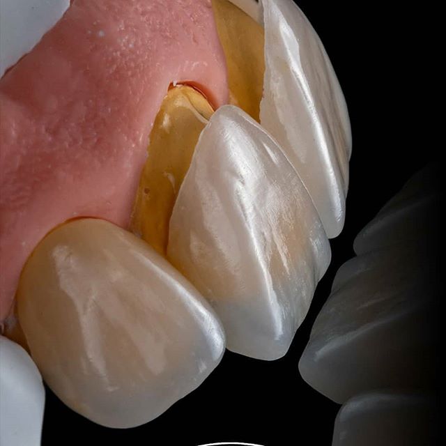 整容不如整牙真的假的,不要整容要整牙