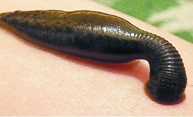 水蛭不小心放到酒精里面就怎么样,水蛭不小心吃进肚