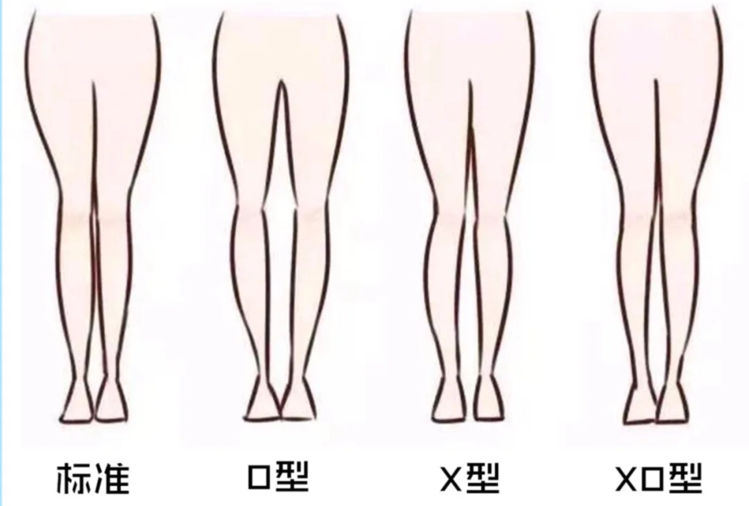 林允黑色罩衫短裤,林允短裤穿搭图片