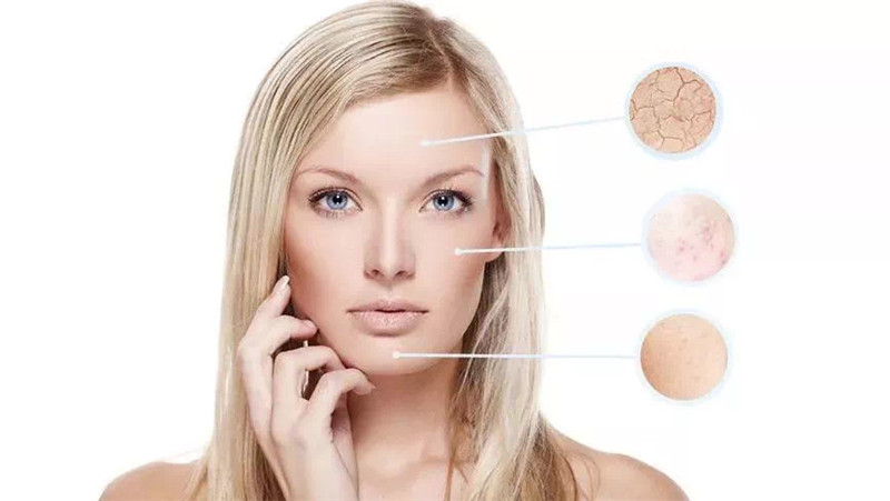 干痒肌肤怎么快速修复,换季皮肤干痒红如何护肤