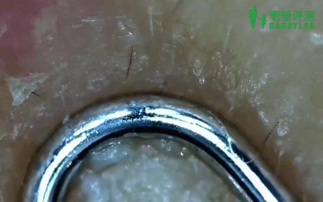 黑头怎么从根部去除,黑头到底怎么去