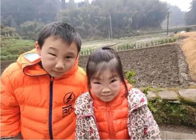 挺漂亮俩孩子，蜜蜂蜇得他妈都不认识了