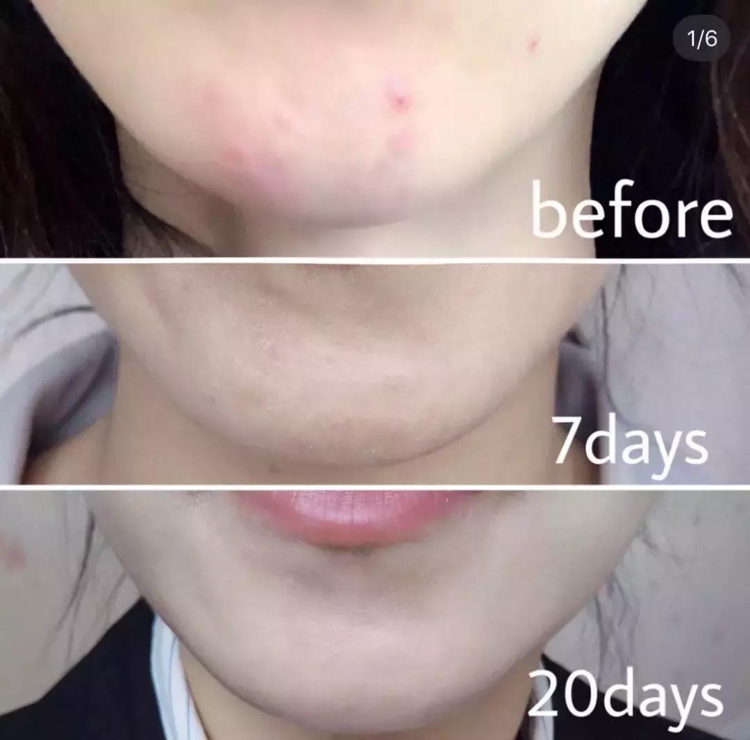 热巴的小细节,热巴一路被黑的经历合集