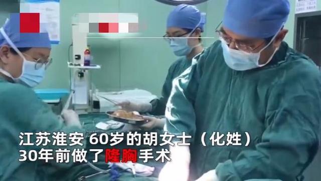 假体隆胸坏死,女子隆胸30年的假体突然破