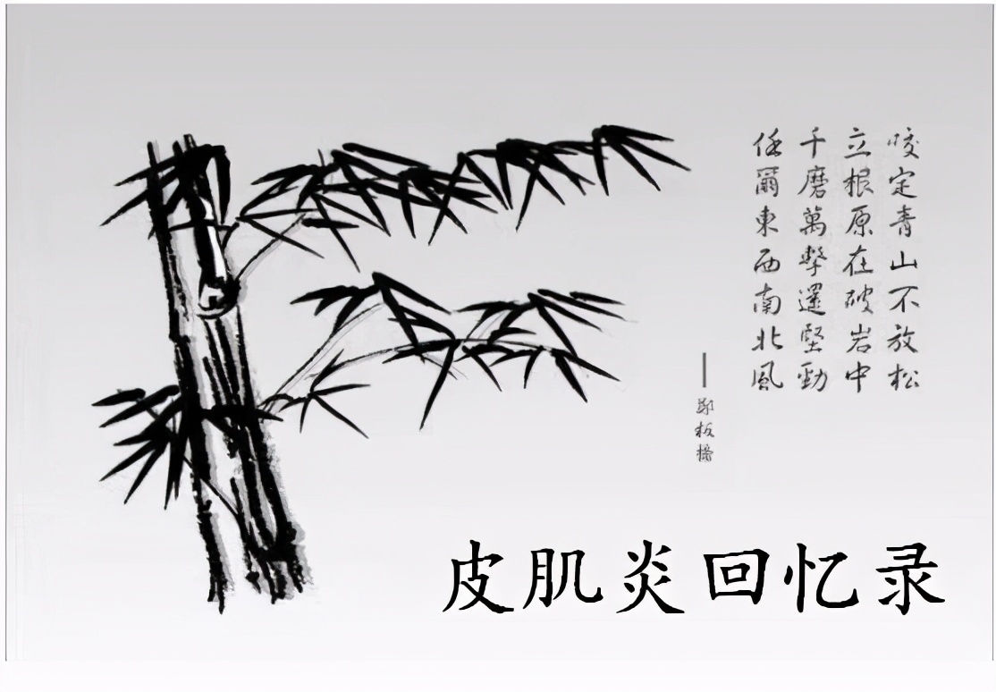 皮肌炎病史,皮肌炎二十年没有治疗