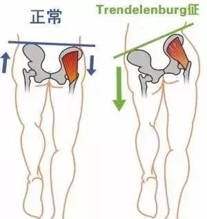 让屁股翘怎么练,让臀部更翘的动作