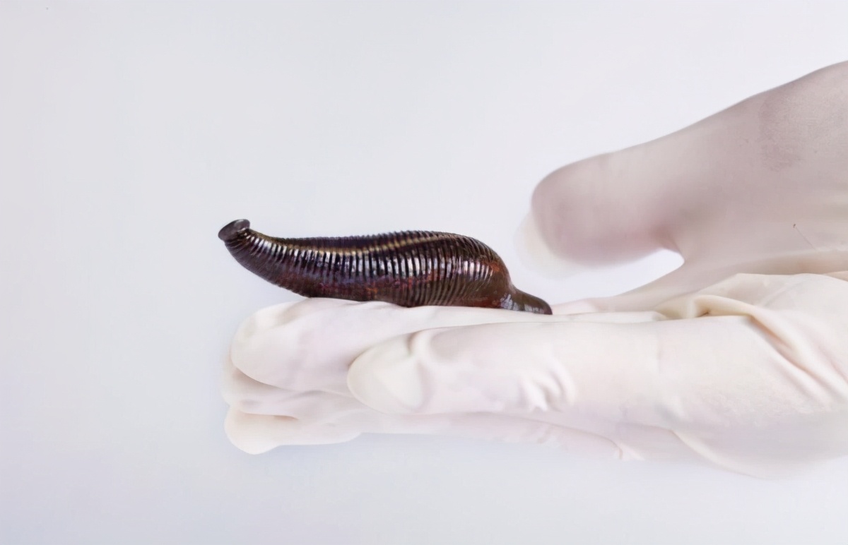 水蛭被吃进肚子里会存活吗,水蛭被人吃进肚子里它能活多久
