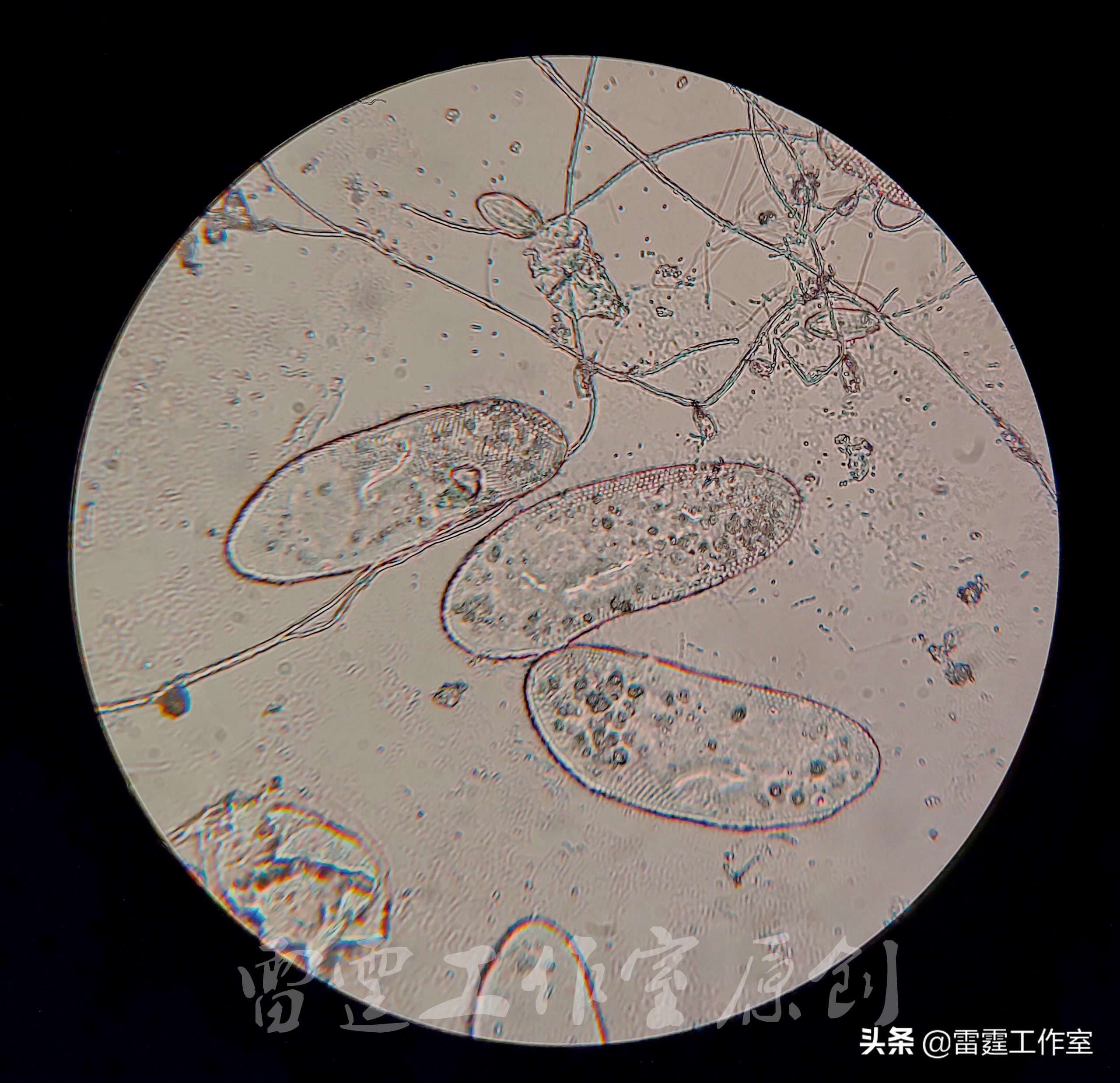 显微观察:带你了解水族箱里的缸红小弟草履虫“鞋垫”的故事