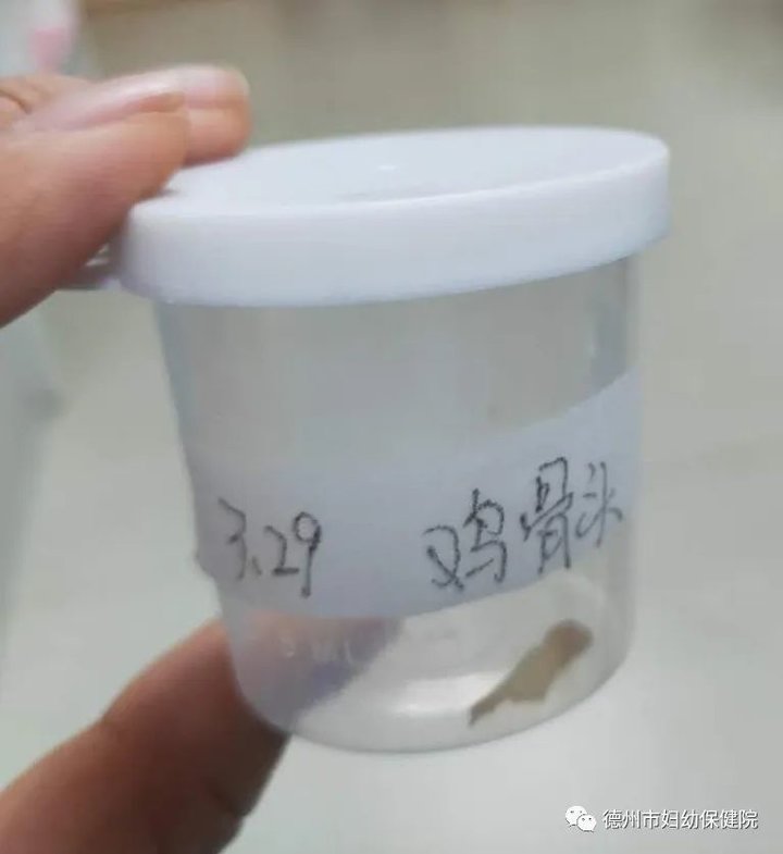 鸡骨头卡在儿童喉咙,鸡骨头呛进肺里