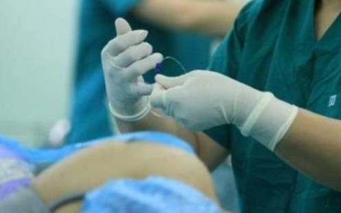 剖腹产是不是要备皮,剖腹产要不要备皮