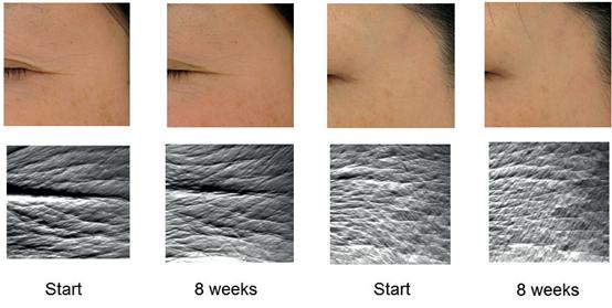 虾青素抗氧化第一名,虾青素地表最强抗氧化剂