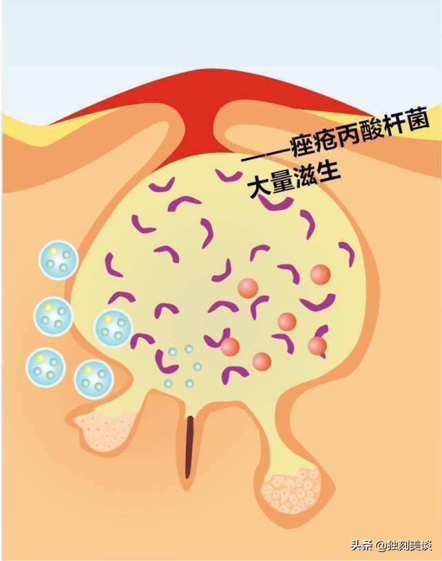 鸡尾酒美白补水,夏日油性皮肤祛痘护理