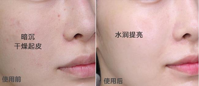 春雨蜂蜜面膜真实测评,春雨蜂蜜面膜用法及功效