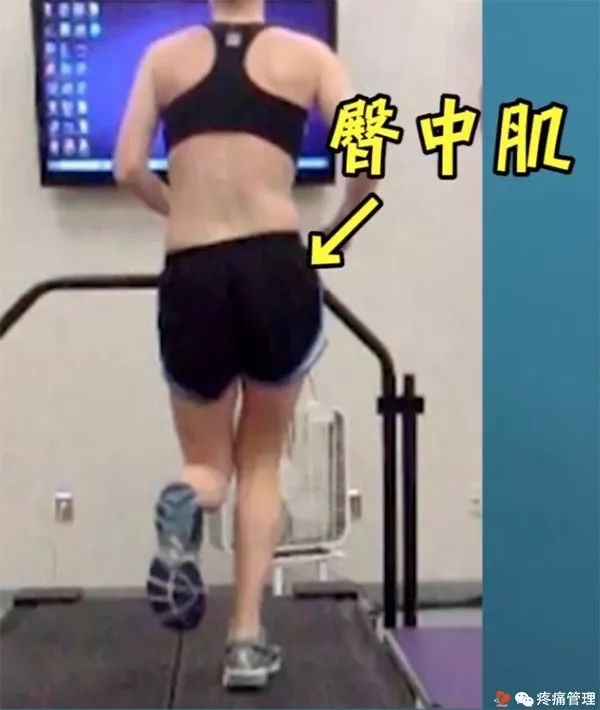 走路屁股扭来扭去是种病，还会导致腰痛、脚痛