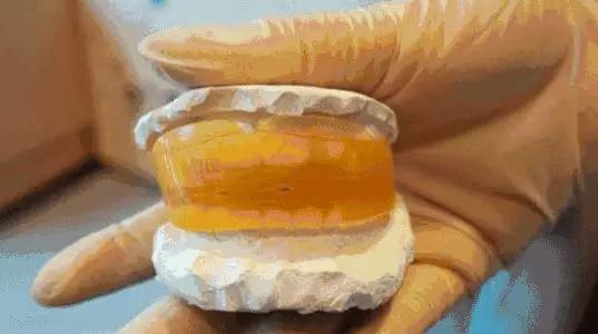 惊“牙”！每4个小朋友里就有3个牙列不齐