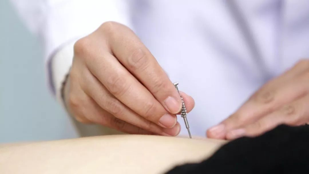 当“古针”遇上糖尿病