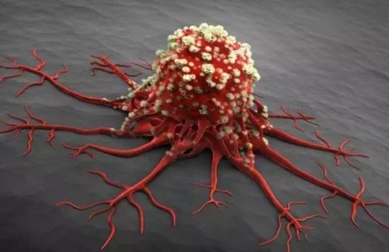 患癌必死无疑？错！善用介入疗法，恶性肿瘤患者长期生存不是梦