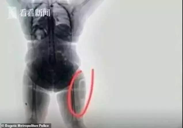 女子向自己的身体“开刀”，再自行缝合！登机时被警方发现异常