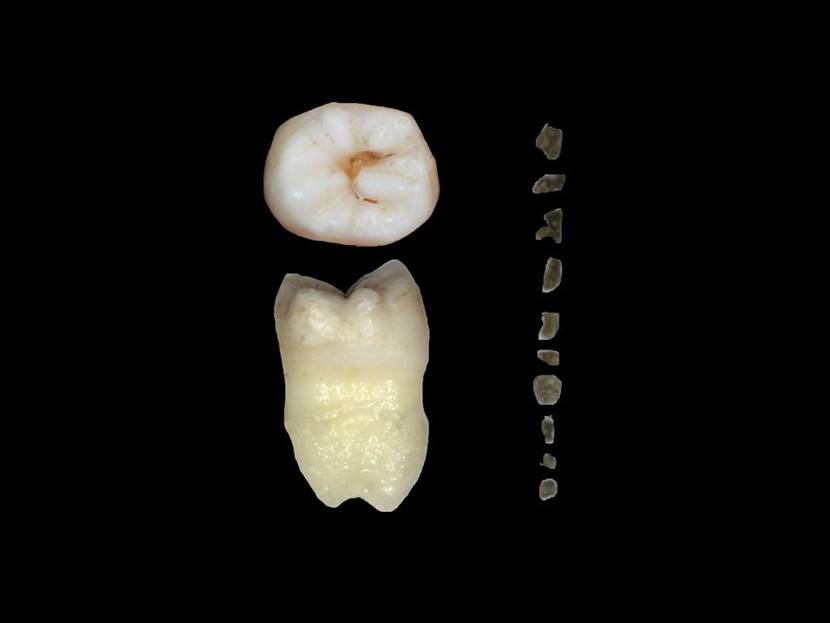 洗牙到底是伤害牙齿还是保护牙齿,洗牙对牙齿伤牙吗