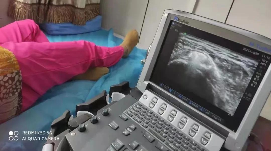 「你是我的眼」——记超声引导下精准疼痛治疗