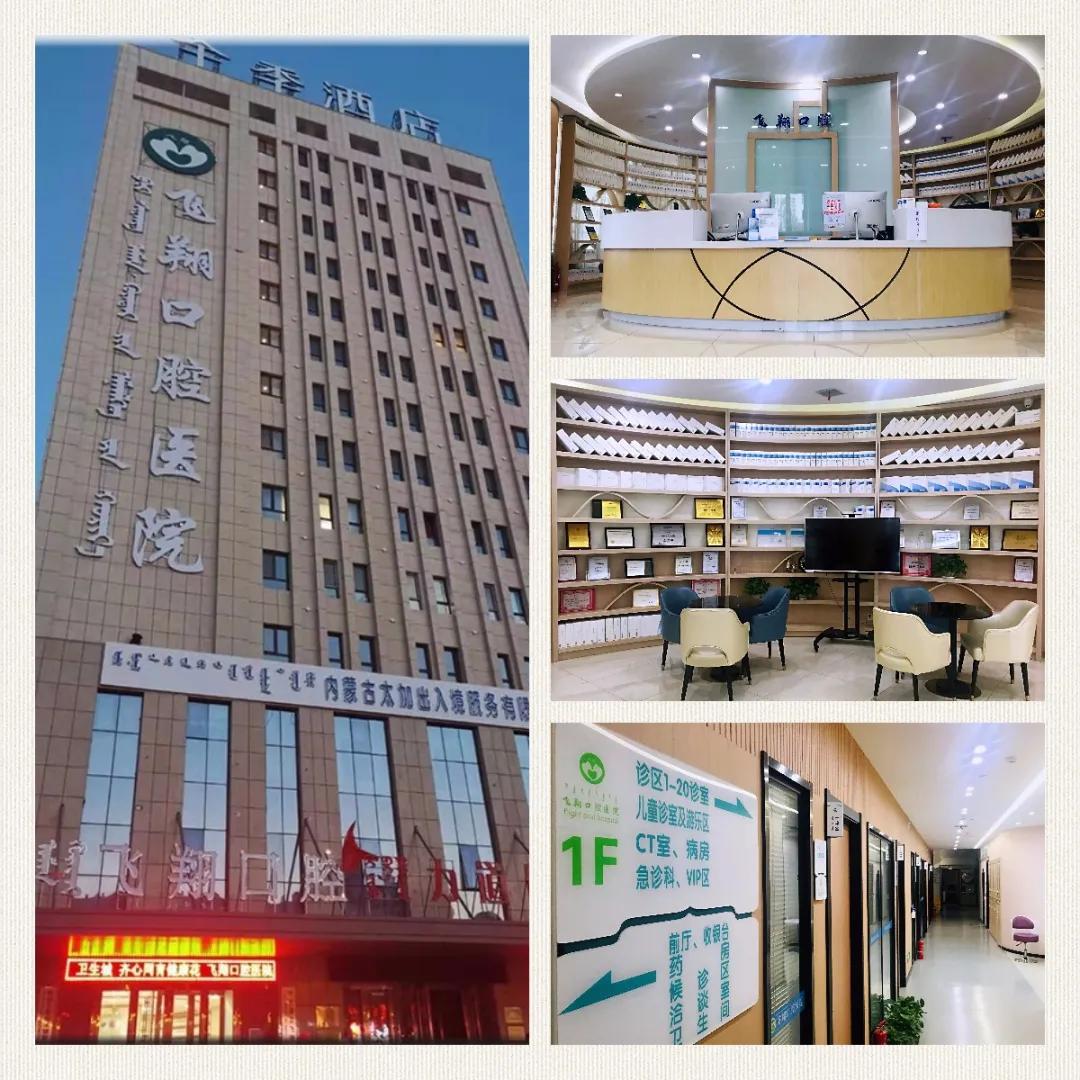 瓷贴面微笑的力量,局部瓷贴面