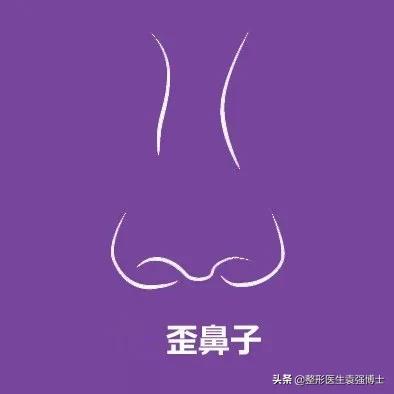 鼻整形如何一步到位,袁博整形医生