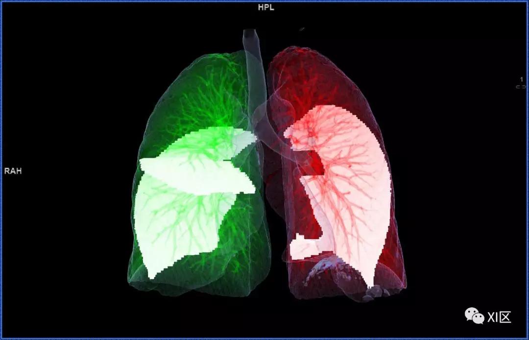 如此详细的肺部影像解剖，有点儿酷