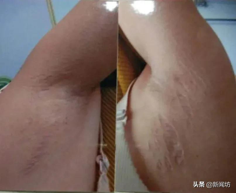 女子被前夫致残难立案,临沂女子被前夫毒害致残