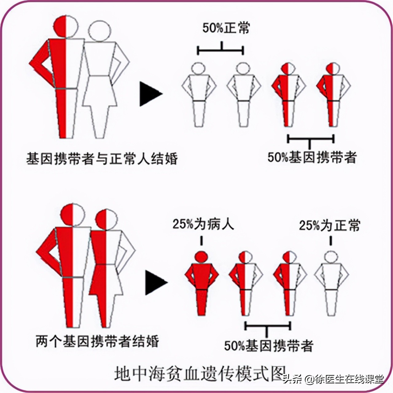 地中海贫血是什么样子,什么是地中海贫血会有什么症状