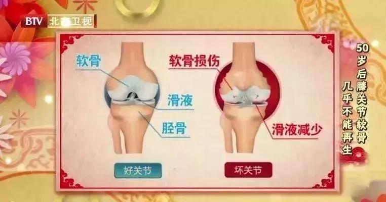 关节抽积液一次费用多少钱,关节有积液看中医还是西医