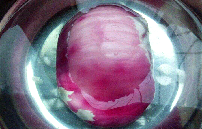 切洋葱切到流泪怎么办,切洋葱已经把眼睛辣了怎么办