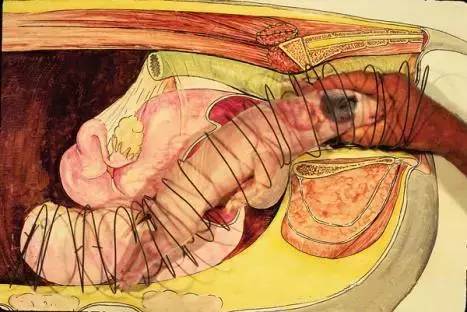 母猪人工助产最新视频,母猪助产钳的使用视频