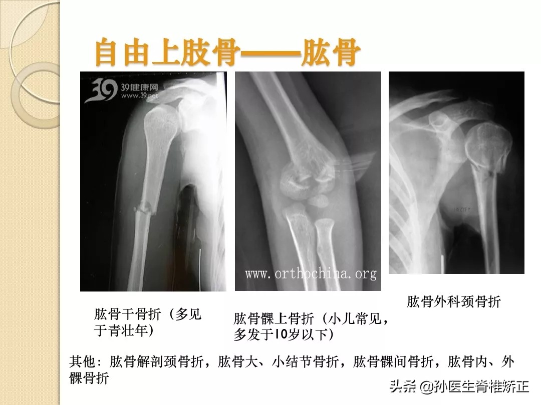 人体解剖学骨骼学思维导图,人体骨骼解剖学纪录片