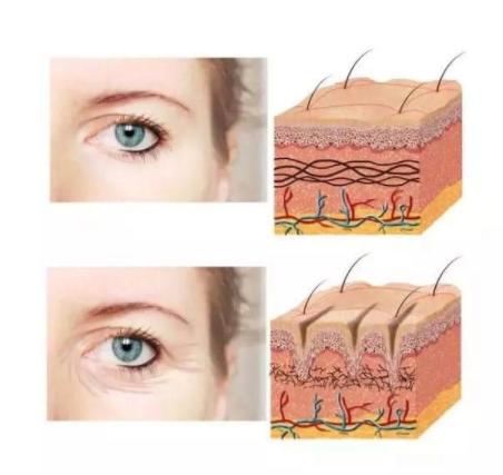 有黑眼圈怎么办如何去除黑眼圈,有黑眼圈该怎么办才能消除黑眼圈
