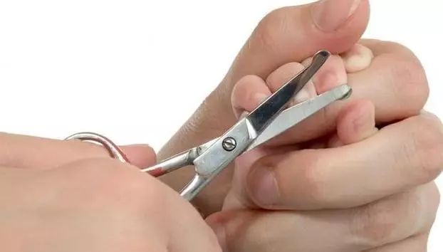 给宝宝剪指甲剪剪得很深怎么办,脚趾甲怎么剪才能不会剪出甲沟炎