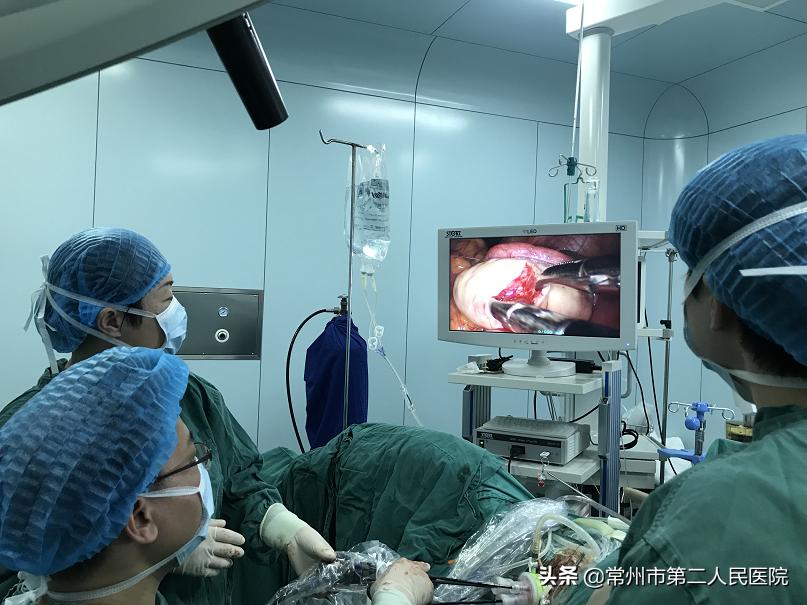 常州二院妇科：安全高效美丽无痕“微创”与“美容”完美结合