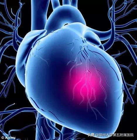 st段改变就是心肌缺血吗,st稍改变一定是心肌缺血吗