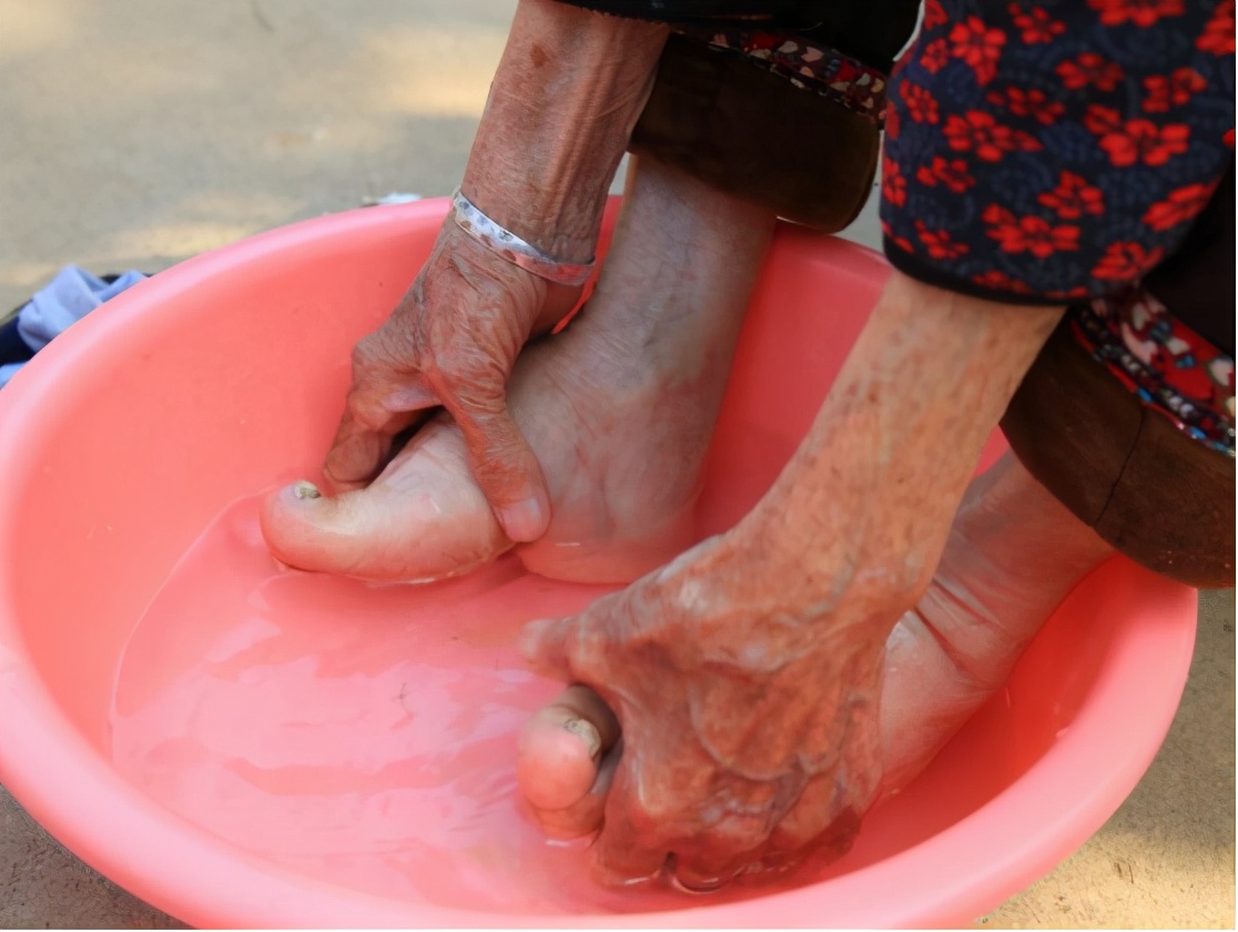 6岁为“美”被迫缠脚:三寸小脚走到百岁,看这位奶奶活成啥样子