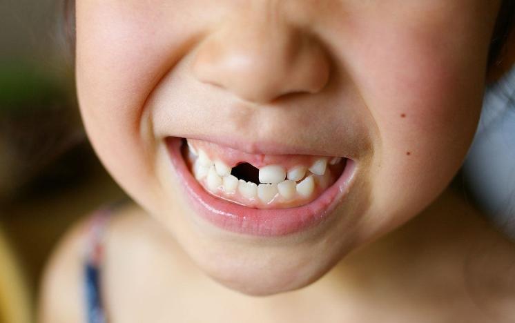 宝宝的乳牙掉了怎么处理,乳牙掉了不要扔关键时刻能救命