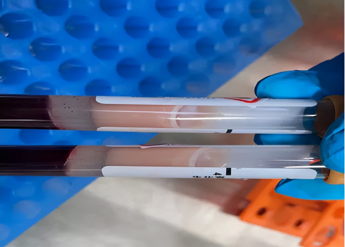 “游走”在全身的油脂,可能随时抢夺你的生命