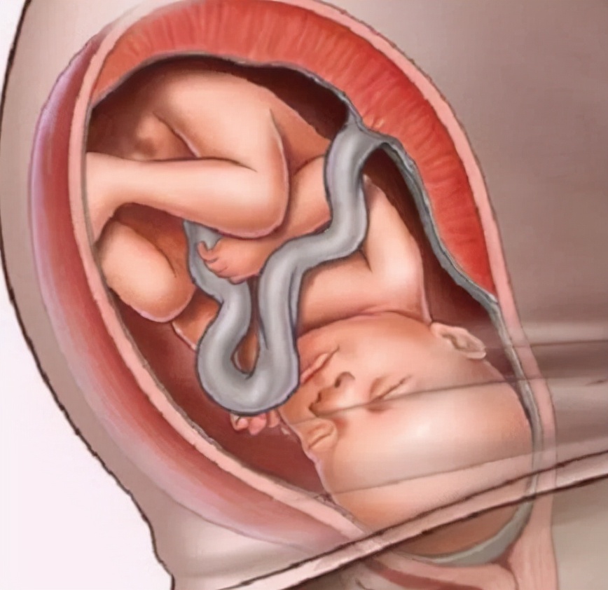 孕后期心情焦虑是因为什么,孕后期情绪会不稳定吗