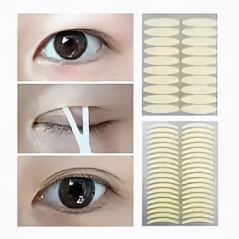 双眼皮不要盲目跟风,别割双眼皮