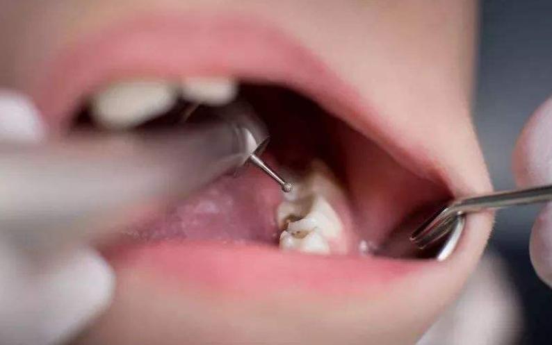 宝宝的乳牙掉了怎么处理,乳牙掉了不要扔关键时刻能救命