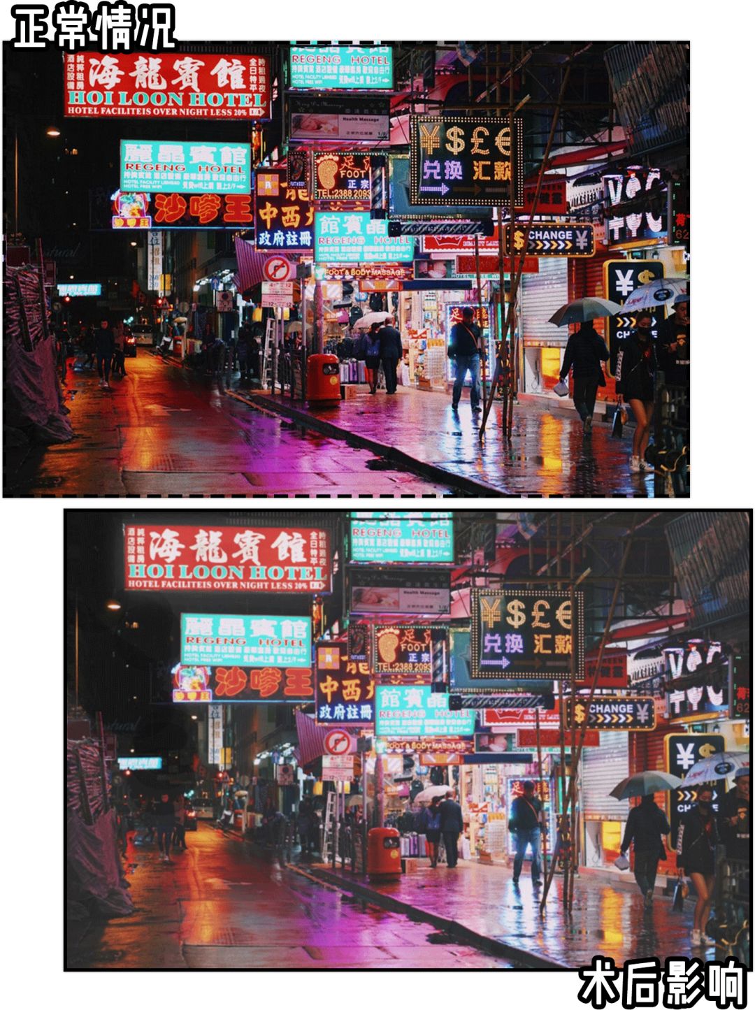 隐形眼镜有散光加近视,近视度数高有散光戴隐形眼镜