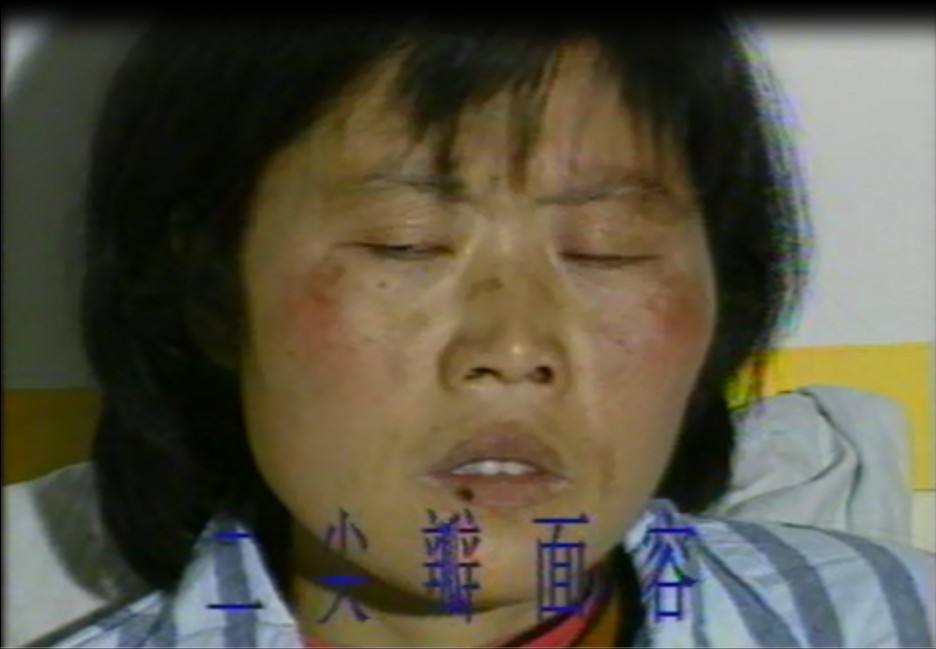 脸红头红要警惕四种病,红脸蛋是有啥病