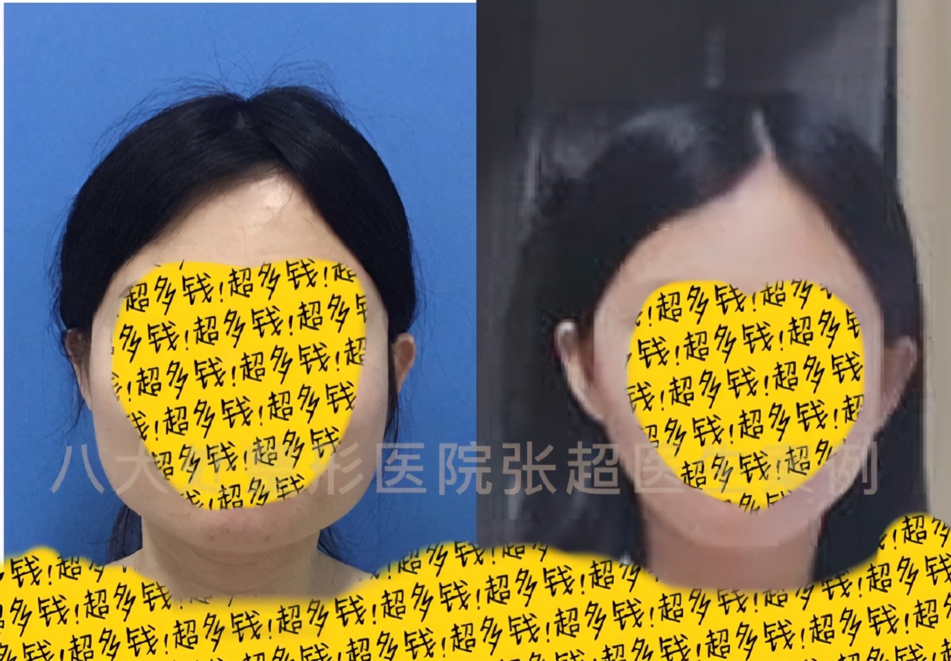 八大处张超抖音,八大处张超合集