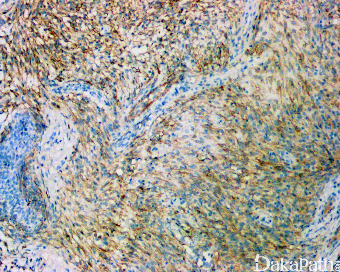 魏则西去世事件是怎么回事,魏则西去世事件原由
