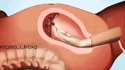 手剥胎盘有多痛可以打麻药不,手剥胎盘会肚子疼吗