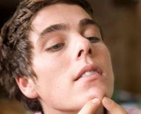 油痘脸解决方法,油腻脸怎么拯救